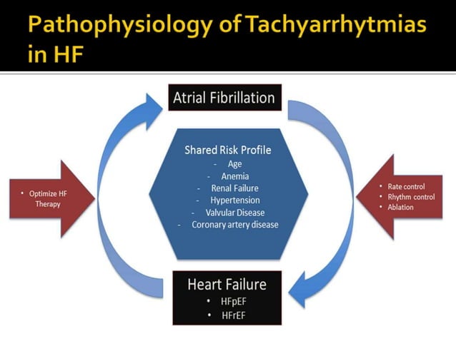 Heart Failure Rythm Heart Failure and Arrhythmia | PPT