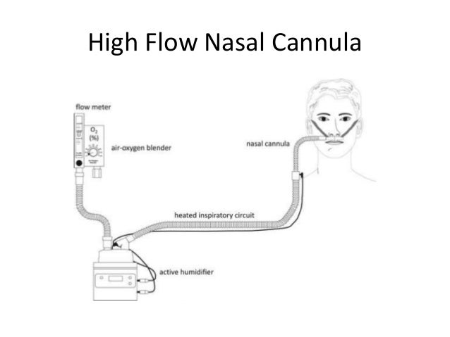nasal cannula prongs
