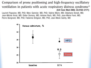 HFO
Prone
 