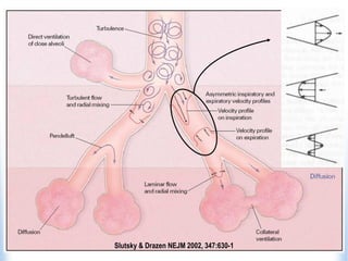 Slutsky & Drazen NEJM 2002, 347:630-1
 