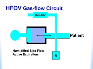 Patient
HFOV Gas-flow Circuit
Humidified Bias Flow
Active Expiration R
Humidifier
 