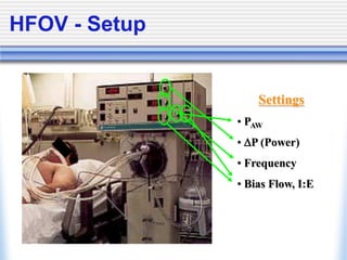 HFOV - Setup
Settings
• PAW
• P (Power)
• Frequency
• Bias Flow, I:E
 