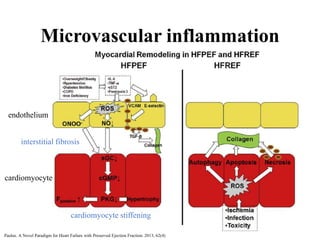 Microvascular inflammation
endothelium
cardiomyocyte
interstitial fibrosis
cardiomyocyte stiffening
Paulus. A Novel Paradigm for Heart Failure with Preserved Ejection Fraction. 2013; 62(4)
 