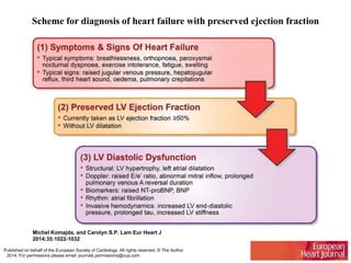 Scheme for diagnosis of heart failure with preserved ejection fraction
Michel Komajda, and Carolyn S.P. Lam Eur Heart J
2014;35:1022-1032
Published on behalf of the European Society of Cardiology. All rights reserved. © The Author
2014. For permissions please email: journals.permissions@oup.com
 