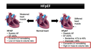 HFpEF
 
