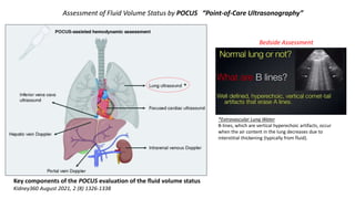 Key components of the POCUS evaluation of the fluid volume status
Kidney360 August 2021, 2 (8) 1326-1338
Assessment of Fluid Volume Status by POCUS “Point-of-Care Ultrasonography”
Bedside Assessment
*Extravascular Lung Water
B-lines, which are vertical hyperechoic artifacts, occur
when the air content in the lung decreases due to
interstitial thickening (typically from fluid).
*
 