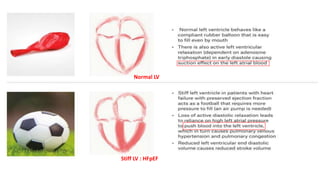Normal LV
Stiff LV : HFpEF
 