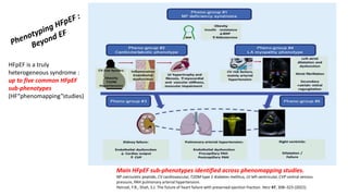 Main HFpEF sub-phenotypes identified across phenomapping studies.
NP natriuretic peptide, CV cardiovascular, T2DM type 2 diabetes mellitus, LV left ventricular, CVP central venous
pressure, PAH pulmonary arterial hypertension.
Heinzel, F.R., Shah, S.J. The future of heart failure with preserved ejection fraction. Herz 47, 308–323 (2022).
HFpEF is a truly
heterogeneous syndrome :
up to five common HFpEF
sub-phenotypes
(HF“phenomapping”studies)
 