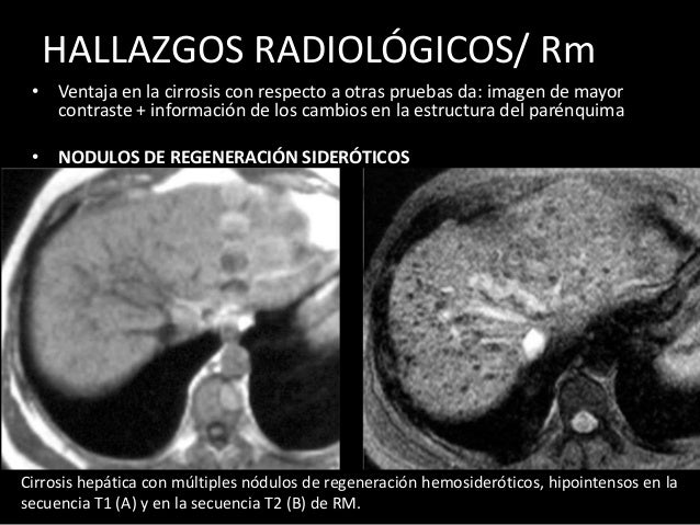 PATOLOGIAS HEP TICAS PROYECTADAS EN ECO TC Y RMN patologias-hep-ticas-proyectadas-en-eco-tc-y-rmn