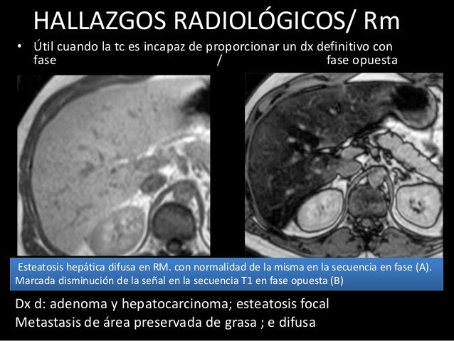 PATOLOGIAS HEP TICAS PROYECTADAS EN ECO TC Y RMN patologias-hep-ticas-proyectadas-en-eco-tc-y-rmn