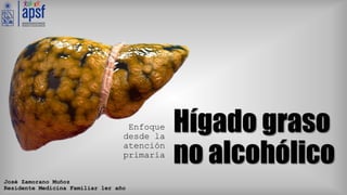 Hígado graso
no alcohólico
Enfoque
desde la
atención
primaria
José Zamorano Muñoz
Residente Medicina Familiar 1er año
 