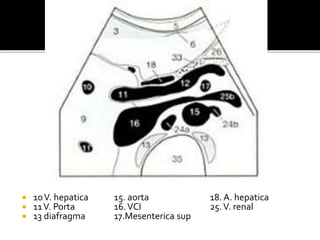  10V. hepatica 15. aorta 18. A. hepatica
 11V. Porta 16.VCI 25.V. renal
 13 diafragma 17.Mesenterica sup
 