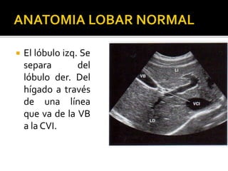  El lóbulo izq. Se
separa del
lóbulo der. Del
hígado a través
de una línea
que va de la VB
a la CVI.
 