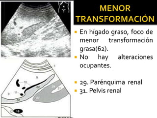  En hígado graso, foco de
menor transformación
grasa(62).
 No hay alteraciones
ocupantes.
 29. Parénquima renal
 31. Pelvis renal
 