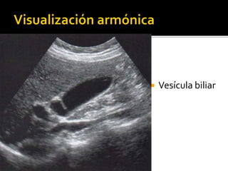  Vesícula biliar
 