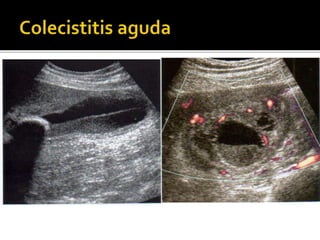 Hígado y vías biliares