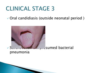  Oral candidiasis (outside neonatal period ) 
 Severe recurrent presumed bacterial 
pneumonia 
 