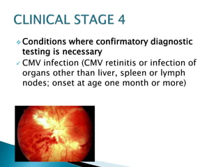 Conditions where confirmatory diagnostic 
testing is necessary 
 CMV infection (CMV retinitis or infection of 
organs other than liver, spleen or lymph 
nodes; onset at age one month or more) 
 