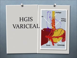 HGIS
VARICEAL
 