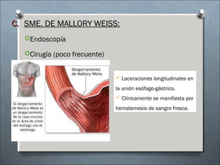C.C. SME. DE MALLORY WEISS:SME. DE MALLORY WEISS:
Endoscopía
Cirugía (poco frecuente)
 Laceraciones longitudinales en
la unión esófago-gástrico.
 Clínicamente se manifiesta por
hematemesis de sangre fresca.
 
