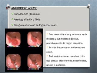 D.D. ANGIODISPLASIAS:ANGIODISPLASIAS:
 Endoscópico (Térmico)
 Arteriografía (Dx y TTO)
 Cirugía (cuando no se logra controlar).
 Son vasos dilatados y tortuosos en la
mucosa y submucosa digestiva,
probablemente de origen adquirido.
 Es más frecuente en ancianos y en
colon.
 Endoscópicamente: manchas color
rojo cereza, arboriformes, superficiales,
únicas o múltiples.
 