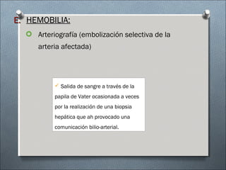 E.E. HEMOBILIA:HEMOBILIA:
 Arteriografía (embolización selectiva de la
arteria afectada)
 Salida de sangre a través de la
papila de Vater ocasionada a veces
por la realización de una biopsia
hepática que ah provocado una
comunicación bilio-arterial.
 