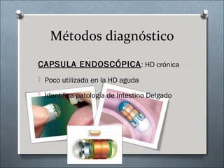 Métodos diagnóstico
CAPSULA ENDOSCÓPICACAPSULA ENDOSCÓPICA: HD crónica
 Poco utilizada en la HD aguda
 Identifica patología de Intestino Delgado
 