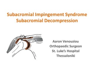 Subacromial Impingement	Syndrome	
Subacromial Decompression	
Aaron	Venouziou
Orthopaedic Surgeon
St.	Luke’s	Hospital
Thessaloniki
 