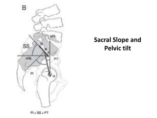 Sacral Slope and
Pelvic tilt
 
