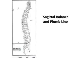 Sagittal Balance
and Plumb Line
 