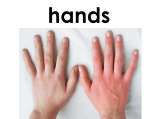 hands

 