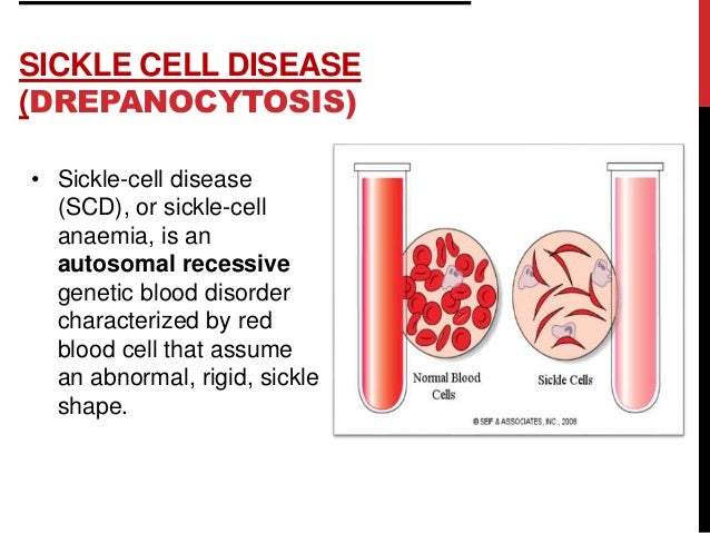 Hereditary Hemolytic Anemias