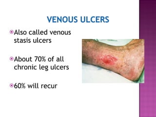 WOUND CARE | PPT
