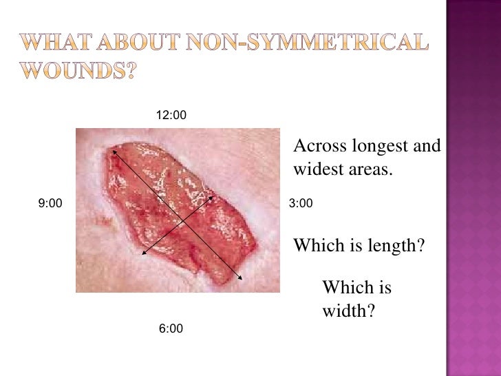 WOUND CARE