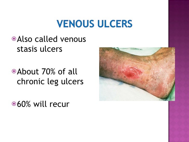 WOUND CARE