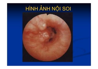 H
H×
×NH ¶NH NéI SOI
NH ¶NH NéI SOI
 