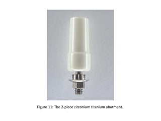 Figure 11: The 2-piece zirconium titanium abutment.
 