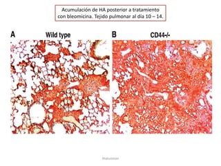 Acumulación de HA posterior a tratamiento
con bleomicina. Tejido pulmonar al día 10 – 14.




                   Hialuronan
 
