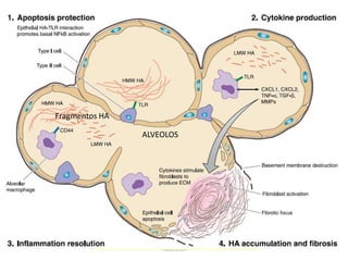 Fragmentos HA

                ALVEOLOS




                    Hialuronan
 