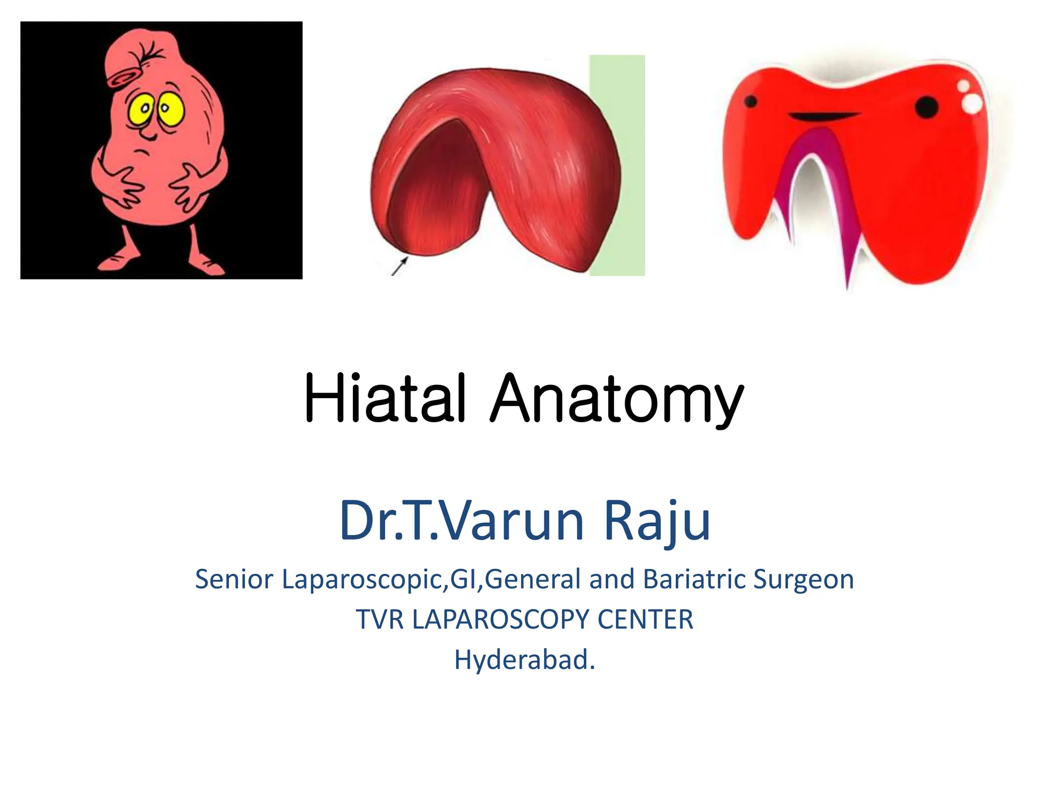 Hiatal Anatomy pptx hiatal-anatomy-pptx