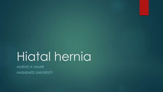 Hiatal hernia
MURAD A’AMAR
HASHEMITE UNIVERSITY
 
