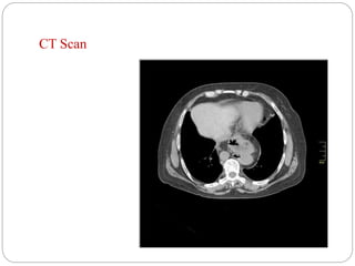 CT Scan
 