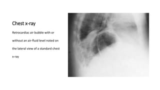 Chest x-ray
Retrocardiac air bubble with or
without an air-fluid level noted on
the lateral view of a standard chest
x-ray
 