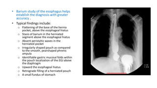 • Barium study of the esophagus helps
establish the diagnosis with greater
accuracy .
• Typical findings include:
o Flattening of the base of the hernia
pocket, above the esophageal hiatus
o Stasis of barium in the herniated
segment above the esophageal hiatus
o Absent peristaltic waves in the
herniated pocket
o Irregularly shaped pouch as compared
to the smooth, pearshaped phrenic
ampula
o Identifiable gastric mucosal folds within
the pouch localization of the EGJ above
the diaphragm
o Upward the esophageal hiatus
o Retrograde filling of a herniated pouch
o A small fundus of stomach
 