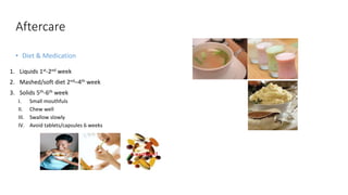 Aftercare
• Diet & Medication
1. Liquids 1st-2nd week
2. Mashed/soft diet 2nd–4th week
3. Solids 5th-6th week
I. Small mouthfuls
II. Chew well
III. Swallow slowly
IV. Avoid tablets/capsules 6 weeks
 