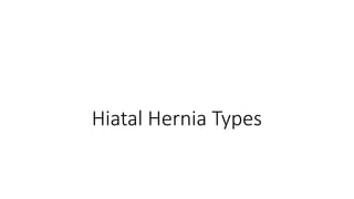 Hiatal Hernia Types
 