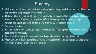 Surgery
1. Make a cranial ventral midline incision extending caudal to the umbilicus to
expose the diaphragm and stomach
2. Retract the left lobes of the liver medially to expose the esophageal hiatus
3. Pass a stomach tube to help identify and manipulate the esophagus
4. Grasp the stomach and reduce the hernia with gentle traction
5. Examine the hiatus
6. Dissect the phrenicoesophageal membrane, freeing the esophagus from the
diaphragm ventrally
7. Preserve the vagal trunks and esophageal vessels during dissection
8. Place an umbilical tape sling around the abdominal esophagus to displace it
caudally and facilitate manipulations
 