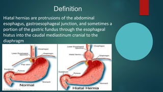 Definition
Hiatal hernias are protrusions of the abdominal
esophagus, gastroesophageal junction, and sometimes a
portion of the gastric fundus through the esophageal
hiatus into the caudal mediastinum cranial to the
diaphragm
 