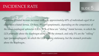Hiatus hernia | PPT