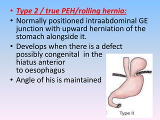 • Type 2 / true PEH/rolling hernia:
• Normally positioned intraabdominal GE
junction with upward herniation of the
stomach alongside it.
• Develops when there is a defect
possibly congenital in the
hiatus anterior
to oesophagus
• Angle of his is maintained
 